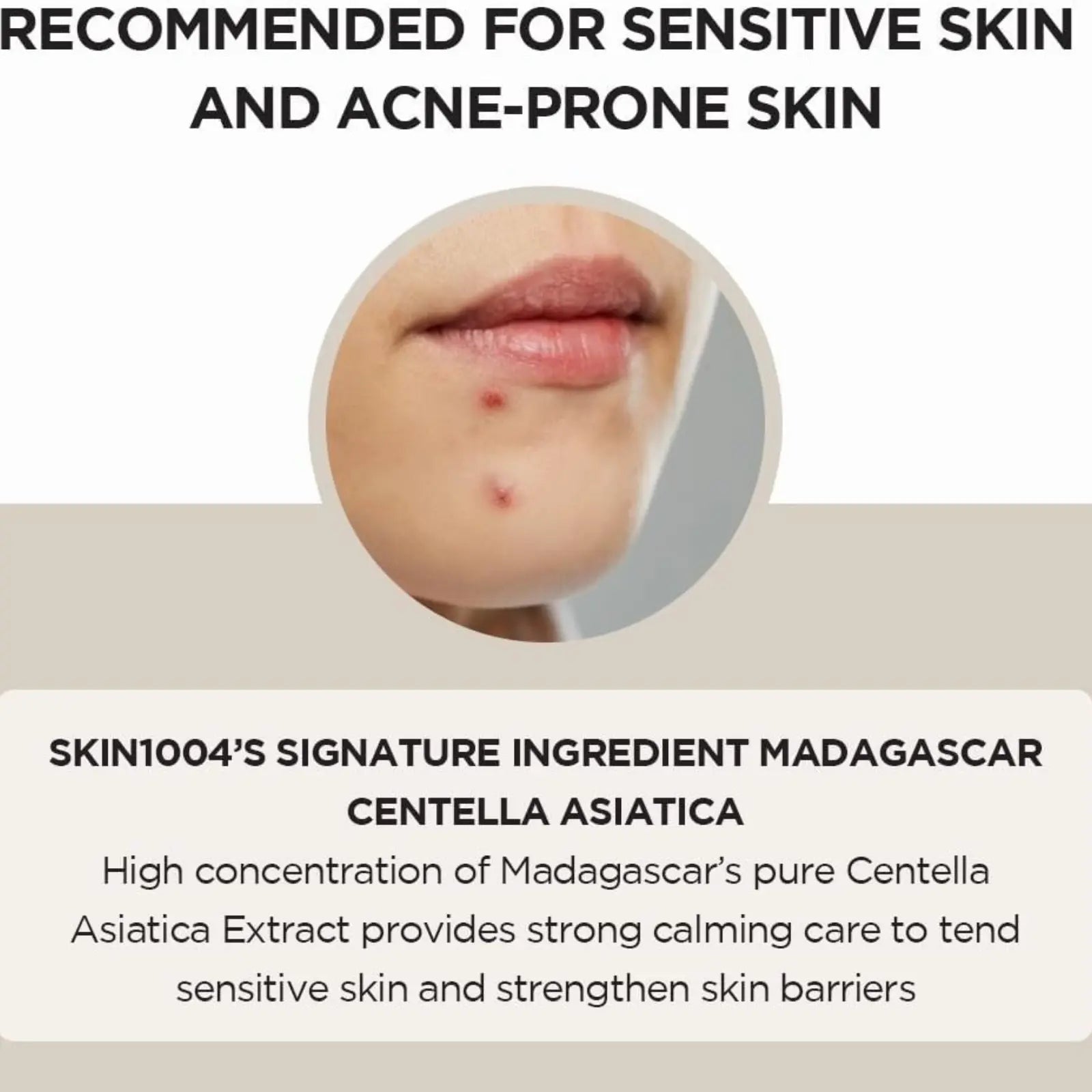 سيروم الوجه أمبولة من سنتيلا اسياتيكا من مدغشقر 100 مل